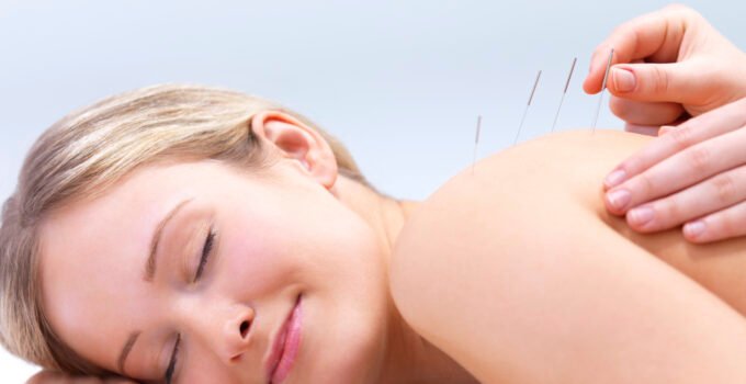 Diet and Acupuncture and the Way Acupuncture is Really Works