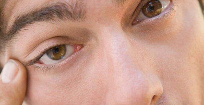 How to Avoid the Dry Eyes Effect